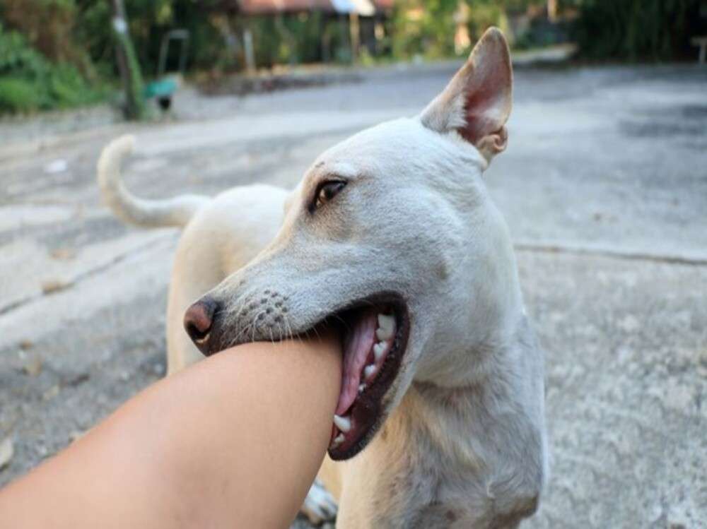 Dog biting person's arm and hand.